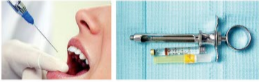 胰島素，牙科麻醉6.png